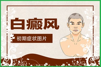白癩風(fēng)遮蓋液去哪家買好，什么牌子的比較好用呢