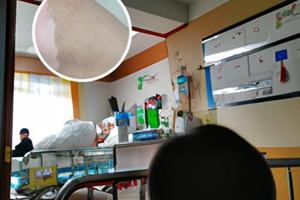 體內(nèi)黑色素過多怎么去除
